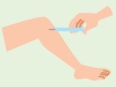 PFC-FD（PRP-FD）療法の注射の画像