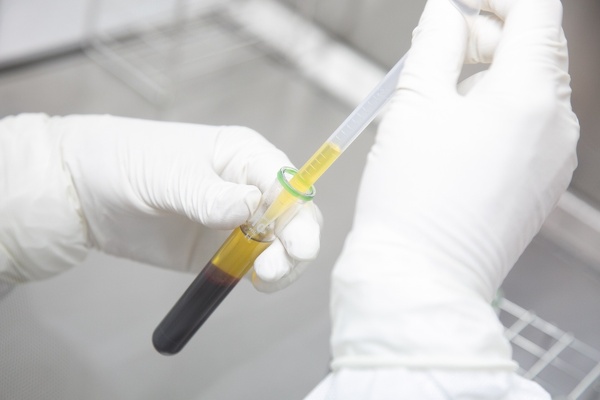 PFC-FD（PRP-FD）療法の採血イメージ写真