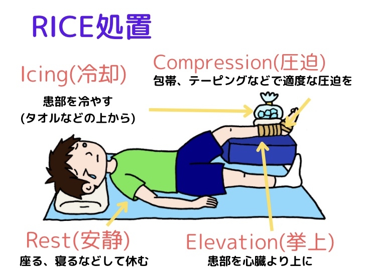 RICE処置